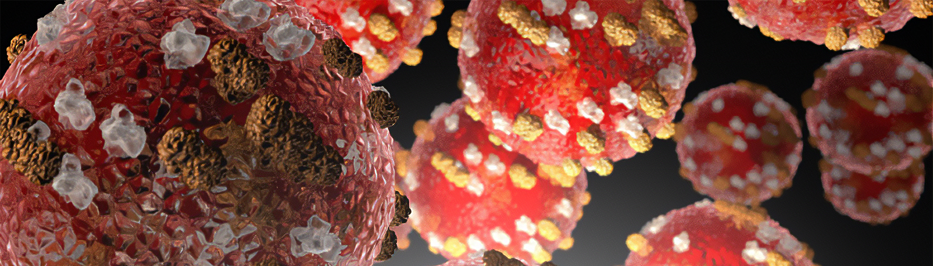 Measles